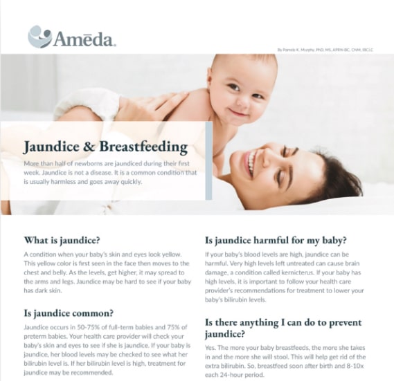 Jaundice & Breastfeeding